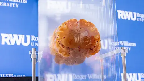 A brain sits on display at RWU's second annual Brain Fair.